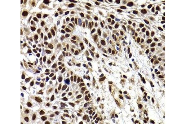 HIRIP3 antibody