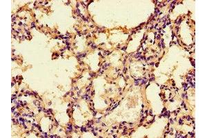 Immunohistochemistry of paraffin-embedded human lung tissue using ABIN7142675 at dilution of 1:100 (PRKAA1 antibody  (Catalytic Subunit alpha))