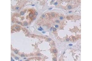 Used in DAB staining on fromalin fixed paraffin- embedded Kidney tissue (FRK antibody  (AA 234-491))