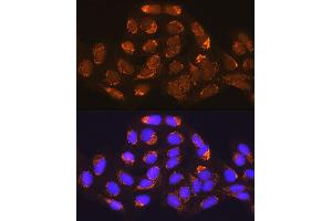 Immunofluorescence analysis of U-2 OS cells using MUT Rabbit pAb (ABIN1680932, ABIN3018357, ABIN3018358 and ABIN6220443) at dilution of 1:100 (40x lens). (MUT antibody  (AA 451-750))
