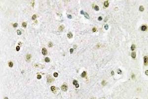 Immunohistochemistry (IHC) analyzes of DGK-theta antibody in paraffin-embedded human brain tissue. (DGKQ antibody)
