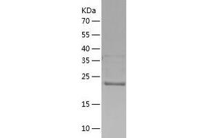 Western Blotting (WB) image for Interleukin 21 Receptor (IL21R) (AA 20-232) protein (His tag) (ABIN7123573) (IL21 Receptor Protein (AA 20-232) (His tag))