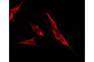 ABIN6276252 staining MCF7 by IF/ICC. (OR51H1 antibody  (N-Term))
