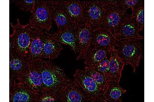 Immunofluorescence (IF) image for anti-Spleen tyrosine Kinase (SYK) (AA 5-360) antibody (ABIN94475)
