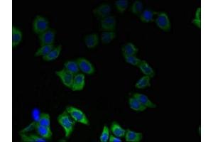 Immunofluorescent analysis of LO2 cells using ABIN7173950 at dilution of 1:100 and Alexa Fluor 488-congugated AffiniPure Goat Anti-Rabbit IgG(H+L) (Type 2 Phosphatidylinositol 4,5-Bisphosphate 4-Phosphatase (PIP4P2) (AA 1-191) antibody)