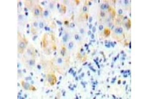 Used in DAB staining on fromalin fixed paraffin-embedded Liver tissue (SIGLEC12 antibody  (AA 27-141))