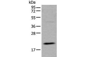 Western blot analysis of RAW264. (UFC1 antibody)