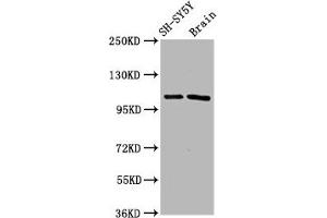 Western Blot Positive WB detected in: SH-SY5Y whole cell lysate, Rat brain tissue All lanes: FBXO10 antibody at 4. (Cyclin F antibody  (AA 248-400))