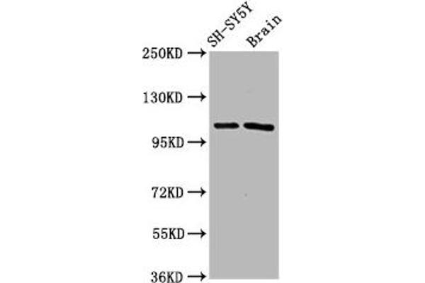 Cyclin F anticorps  (AA 248-400)