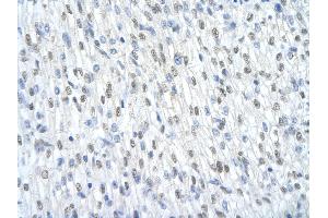Immunohistochemistry (IHC) image for anti-Splicing Factor 3b, Subunit 1, 155kDa (SF3B1) (Middle Region) antibody (ABIN2778699)