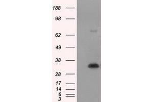 Western Blotting (WB) image for anti-Nitrilase 1 (NIT1) antibody (ABIN1499736) (Nitrilase 1 antibody)