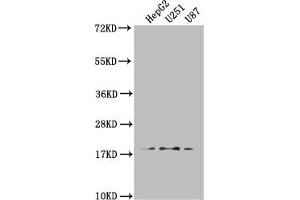 Western Blot Positive WB detected in: HepG2 whole cell lysate, U251 whole cell lysate, U87 whole cell lysate All lanes: ARL2BP antibody at 1:1000 Secondary Goat polyclonal to rabbit IgG at 1/50000 dilution Predicted band size: 19, 18 kDa Observed band size: 19 kDa