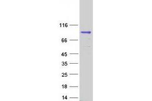 Validation with Western Blot (DUS3L Protein (Myc-DYKDDDDK Tag))