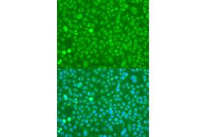 Immunofluorescence (IF) image for anti-Ubiquitin C (UBC) (AA 1-100) antibody (ABIN1683190)