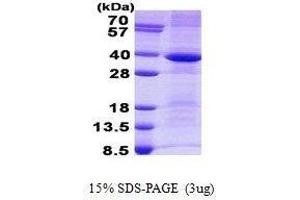 Figure annotation denotes ug of protein loaded and % gel used. (Cathepsin S Protein (CTSS))