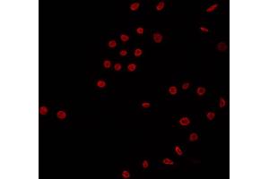ABIN6266681 staining K562 by IF/ICC. (NK6 Homeobox 3 antibody  (Internal Region))