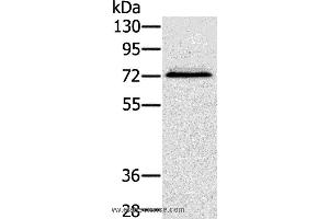 Western blot analysis of Hepg2 cell, using SSX2IP Polyclonal Antibody at dilution of 1:500 (SSX2IP antibody)