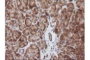 Image no. 2 for anti-RIO Kinase 2 (RIOK2) (AA 277-552) antibody (ABIN1491305) (RIOK2 antibody  (AA 277-552))