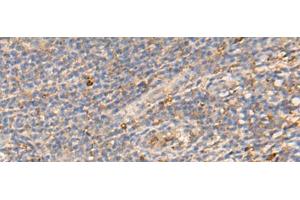 Immunohistochemistry of paraffin-embedded Human tonsil tissue using PDIA5 Polyclonal Antibody at dilution of 1:50(x200) (PDIA5 antibody)