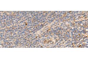 Immunohistochemistry of paraffin-embedded Human tonsil tissue using PDIA5 Polyclonal Antibody at dilution of 1:50(x200) (PDIA5 antibody)