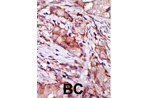Immunohistochemistry (IHC) image for anti-KIP2 antibody (ABIN3003730) (KIP2 antibody)