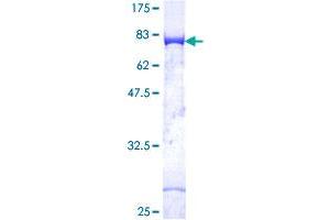 Image no. 1 for C-Src tyrosine Kinase (CSK) (AA 1-450) protein (GST tag) (ABIN1350517) (CSK Protein (AA 1-450) (GST tag))