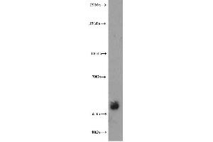 Western Blotting (WB) image for anti-Extracellular Matrix Protein 1 (ECM1) antibody (ABIN2928444) (ECM1 antibody)