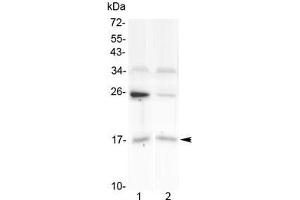 Western blot testing of human 1) U-87 MG and 2) placenta lysate with IL1F10 antibody at 0.