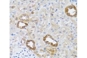 Immunohistochemistry of paraffin-embedded Rat kidney using RNASEL Polyclonal Antibody at dilution of 1:100 (40x lens). (RNASEL antibody)