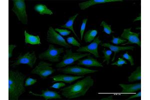 Immunofluorescence of purified MaxPab antibody to MASP1 on HeLa cell. (MASP1 antibody  (AA 1-380))