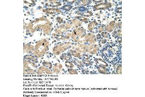 Human kidney (DMRT2 antibody  (N-Term))