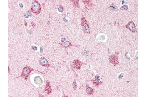 Immunohistochemistry (Paraffin-embedded Sections) (IHC (p)) image for anti-Prostaglandin D2 Receptor 2 (PTGDR2) (N-Term) antibody (ABIN615056)