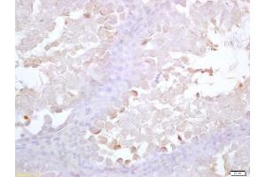 Formalin-fixed and paraffin embedded rat testis labeled with Anti-Acrosin Polyclonal Antibody, Unconjugated (ABIN1387665) at 1:200 followed by conjugation to the secondary antibody and DAB staining (Acrosin antibody  (AA 201-300))