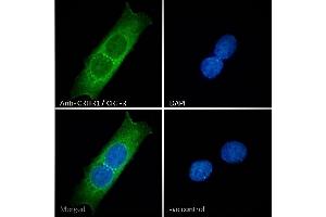 ABIN238557 Immunofluorescence analysis of paraformaldehyde fixed MCF7 cells, permeabilized with 0. (CRHR1 antibody  (AA 107-117))