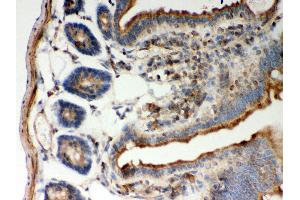 Anti- STIM1 Picoband antibody, IHC(P) IHC(P): Mouse Intestine Tissue (STIM1 antibody  (N-Term))