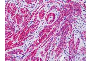 Human Uterus: Formalin-Fixed, Paraffin-Embedded (FFPE) (ACTG2 antibody  (N-Term))