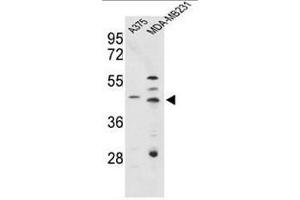 Western blot analysis of CTSD Antibody (C-term) in A375, MDA-MB231 cell line lysates (35µg/lane). (Cathepsin D antibody  (C-Term))