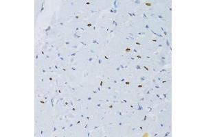 Immunohistochemistry of paraffin-embedded rat heart using SNRNP70 antibody. (SNRNP70 antibody  (AA 150-250))