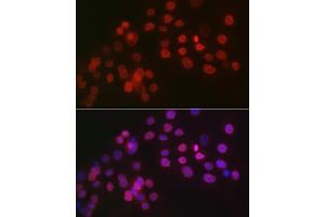 Immunofluorescence analysis of OVCAR-3 cells using WT1 Rabbit pAb (ABIN7271369) at dilution of 1:100 (40x lens). (WT1 antibody  (AA 1-302))