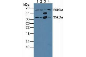 Figure. (GNB2 antibody  (AA 2-340))