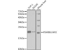 Western blot analysis of extracts of various cell lines, using PSMB9/LMP2 antibody (ABIN3022517, ABIN3022518, ABIN3022519 and ABIN6218874) at 1:1000 dilution. (PSMB9 antibody  (AA 1-219))
