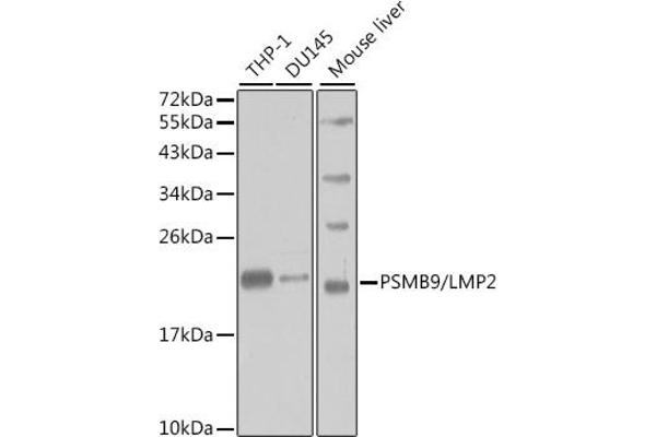 PSMB9 anticorps  (AA 1-219)