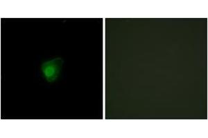 Immunofluorescence analysis of HepG2 cells, using SMG7 Antibody. (SMG7 antibody  (AA 521-570))