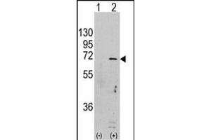 Western blot analysis of PRK (arrow) using rabbit polyclonal PRK Antibody  (ABIN391388 and ABIN2837970).