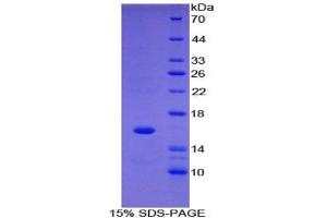 SDS-PAGE of Protein Standard from the Kit (Highly purified E. (FABP1 ELISA Kit)