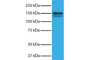 Purified Human Type I Collagen secondary antibody and chemiluminescent detection. (Donkey anti-Goat IgG (Heavy & Light Chain) Antibody (HRP) - Preadsorbed)