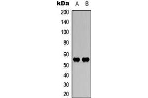 Western blot analysis of WASF3 expression in HEK293T (A), mouse brain (B) whole cell lysates.