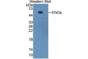Detection of Recombinant FOXP3, Mouse using Polyclonal Antibody to Forkhead Box P3 (FOXP3) (FOXP3 antibody  (AA 190-412))
