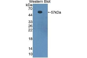 Detection of Recombinant FOXP3, Mouse using Polyclonal Antibody to Forkhead Box P3 (FOXP3) (FOXP3 antibody  (AA 190-412))