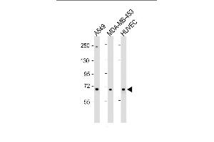 All lanes : Anti-COL8A1 Antibody (N-term) at 1:1000 dilution Lane 1: A549 whole cell lysate Lane 2: MDA-MB-453 whole cell lysate Lane 3: HUVEC whole cell lysate Lysates/proteins at 20 μg per lane. (COL8A1 antibody  (N-Term))